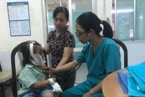 Nghịch chai keo xịt tóc, bé gái 6 tuổi bỏng nặng vùng mặt