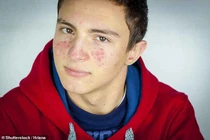 Người mẹ ảnh hưởng đến thời điểm dậy thì của con cái như thế nào?