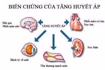 Tăng huyết áp ở bệnh nhân mắc bệnh tự miễn