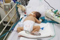 Bác sĩ Nhi cảnh báo triệu chứng đầu tiên của bệnh tay chân miệng, cha mẹ cần chú ý