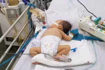 Bác sĩ Nhi cảnh báo triệu chứng đầu tiên của bệnh tay chân miệng, cha mẹ cần chú ý