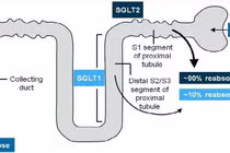 Nhiều glucose trong nước tiểu có đáng lo?