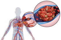 Gần 1/10 số ca ghép phổi là do COVID-19