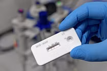 Ca COVID-19 kỷ lục: 221 ngày dương tính 