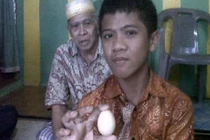 Sự thật bí ẩn gây sốc cậu bé biết đẻ trứng ở Indonesia