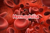 Lưu ý khi tiêm vaccine COVID-19 với người rối loạn đông máu và rối loạn chảy máu