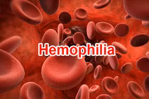 Lưu ý khi tiêm vaccine COVID-19 với người rối loạn đông máu và rối loạn chảy máu