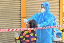 Bộ Y tế quy định thu dịch vụ xét nghiệm Covid-19 như thế nào?