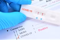 Phó Chủ tịch UBND TPHCM Dương Anh Đức yêu cầu Sở Y tế làm rõ và cung cấp số liệu cụ thể về tổng số kết quả test nhanh dương tính.