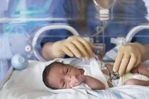 Đẻ ra bị tím có phải tim bẩm sinh?