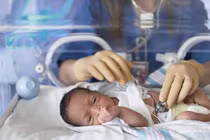 Đẻ ra bị tím có phải tim bẩm sinh?