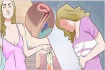 Lệch vòng tránh thai vì chơi thể thao