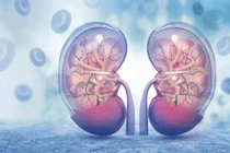 Dấu hiệu ung thư thận không nên bỏ qua