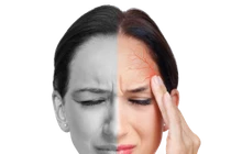 Cách điều trị bệnh đau nửa đầu Migraine