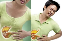 Có cách nào không cần nội soi vẫn tầm soát được ung thư dạ dày?