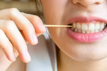 Chăm vệ sinh răng mà vẫn sâu