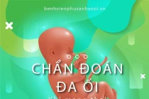 Nguyên nhân gây đa ối 