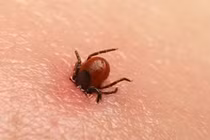 Sốt xuất huyết bọ chét có thể gây tử vong tới 40%