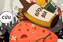 Uống rượu hay uống bia thì đều có nguy cơ mắc các bệnh ung thư dưới đây