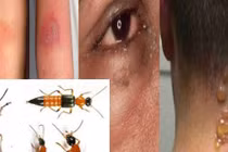 Độc tố kiến ba khoang độc hơn nọc rắn, cẩn thận xử lý kẻo rước hoạ vào thân