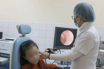 Hạt cườm chui tọt vào tai