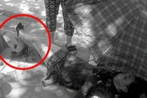 Người phụ nữ bị gãy gập chân vì áo chống nắng cuốn vào bánh xe máy