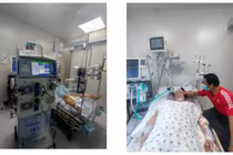 Cảnh báo hội chứng viêm đa hệ thống ở trẻ hậu Covid-19 