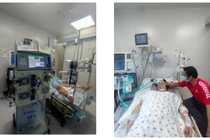 Cảnh báo hội chứng viêm đa hệ thống ở trẻ hậu Covid-19 