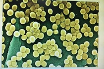 Người bị viêm họng, viêm xoang chế biến thực phẩm có thể gây ngộ độc