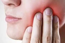Lưu ý khi nhổ răng khôn