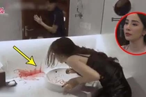 Nôn ra máu do xuất huyết tiêu hóa trên