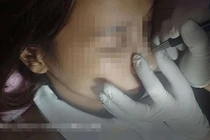 Góc nhìn phóng viên: Lỗ hổng chết người từ cho thuê phòng mổ thẩm mỹ