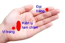  Kích thích huyệt trị liệu đau dạ dày co thắt
