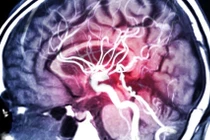 Ảnh chụp cộng hưởng từ MRA mạch máu trong não. Ảnh ScitechDaily
