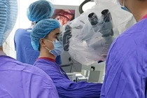 Vi phẫu tách mạch máu chữa đau nửa mặt.