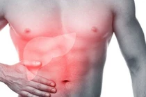 3 nhóm nguyên nhân gây viêm gan