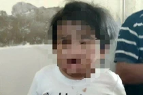 Bệnh viện đa khoa Hà Tĩnh vừa tiếp nhận một bé gái với nhiều vết thương trên người