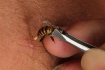 Mẹo tránh bị ong đốt