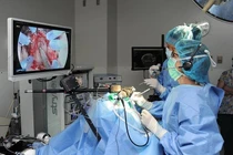 Phẫu thuật u tuyến yên có chữa khỏi bệnh to đầu chi?