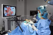 Phẫu thuật u tuyến yên có chữa khỏi bệnh to đầu chi?