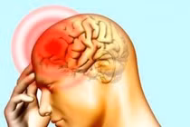 Áp lực dễ dẫn đến thiếu máu não 