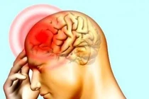 Áp lực dễ dẫn đến thiếu máu não 