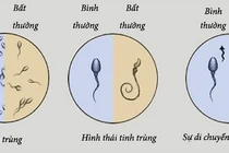 Độ di động của tinh trùng và khả năng thụ thai