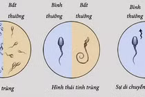 Độ di động của tinh trùng và khả năng thụ thai