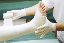 Hạn chế mất máu khi mổ các ca gãy xương nặng bằng phương pháp nào?