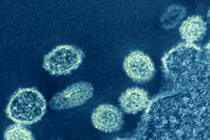 Chủng virus cúm mới được phát hiện ở Trung Quốc có nguy hiểm?