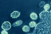 Chủng virus cúm mới được phát hiện ở Trung Quốc có nguy hiểm?