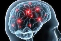 Sa sút trí tuệ đa nhồi máu