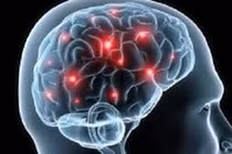 Sa sút trí tuệ đa nhồi máu