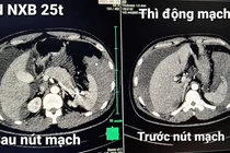 Rối loạn đông máu cần đến viện ngay